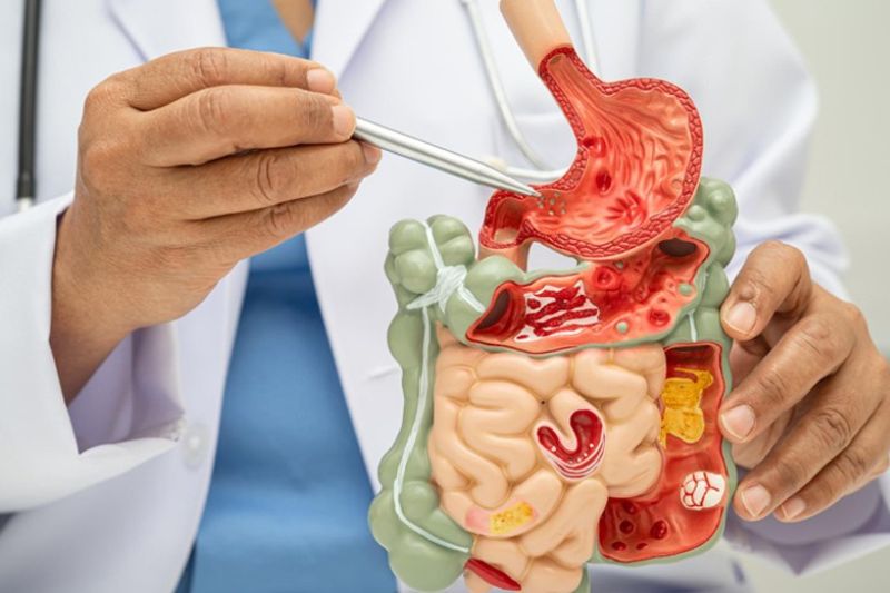 ERCP