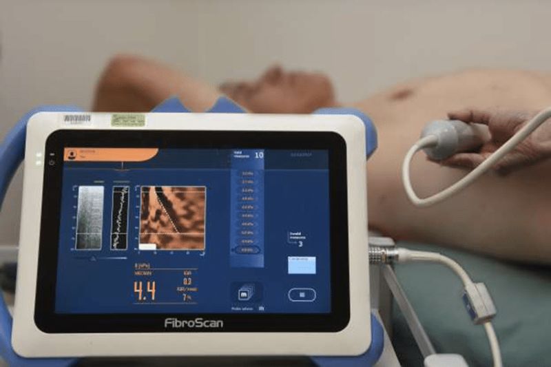 FibroScan Test for Liver